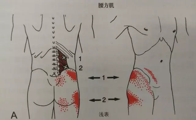 压痛点 臀大肌附着骶骨及髂骨处 膎绳肌附着处:坐骨结节及胫骨后内侧