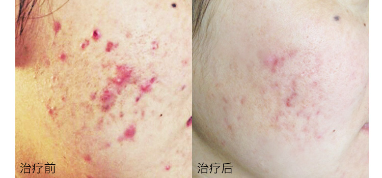 春雨医生 春雨医生