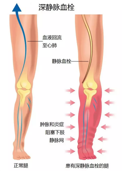 春雨医生