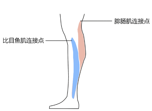 腓肠肌步态图片