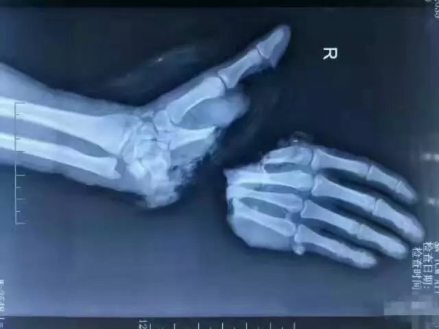 春雨医生 春雨医生