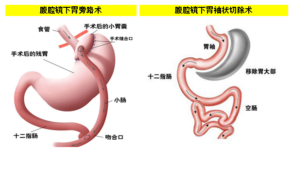 春雨医生