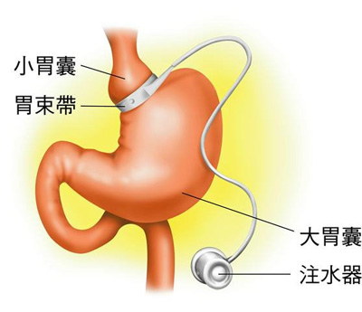 春雨医生