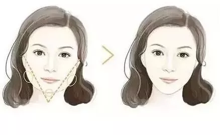 春雨医生
