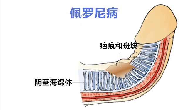 CorpusCavernosum1_副本.jpg