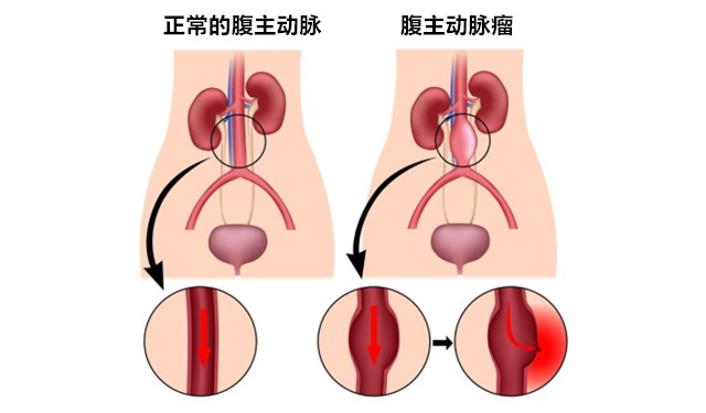要成为屹立不倒的男人，哪些体检必须做？