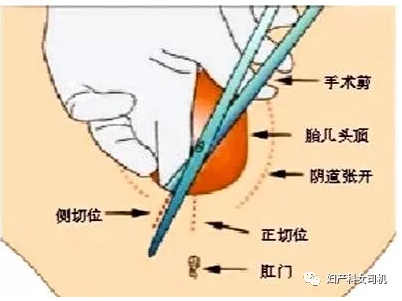 侧切全开有图慎入2017图片