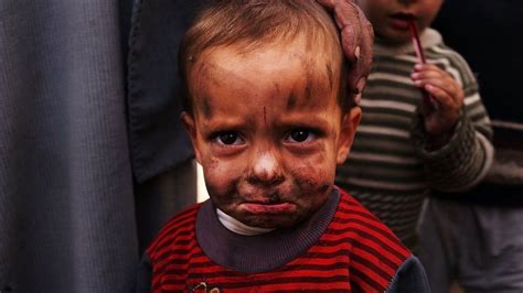 战争中的孩子图片悲惨图片