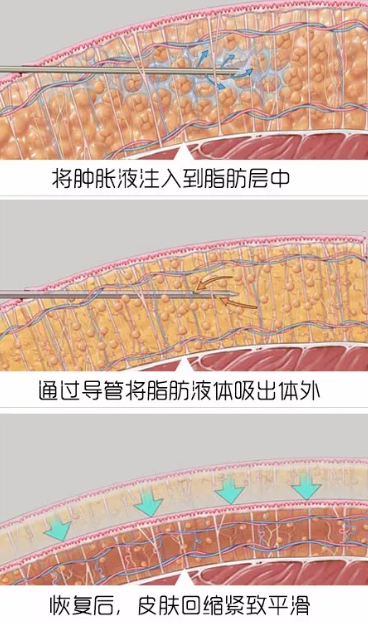 春雨医生