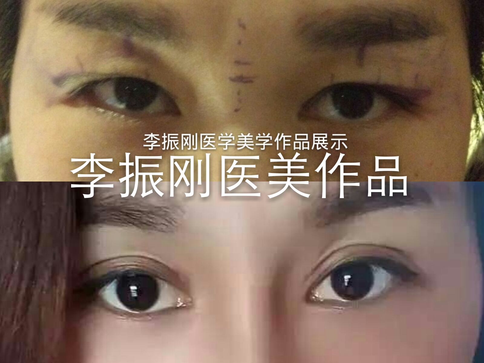 双眼破案例