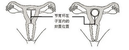 春雨医生 春雨医生