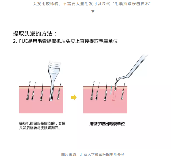 春雨医生