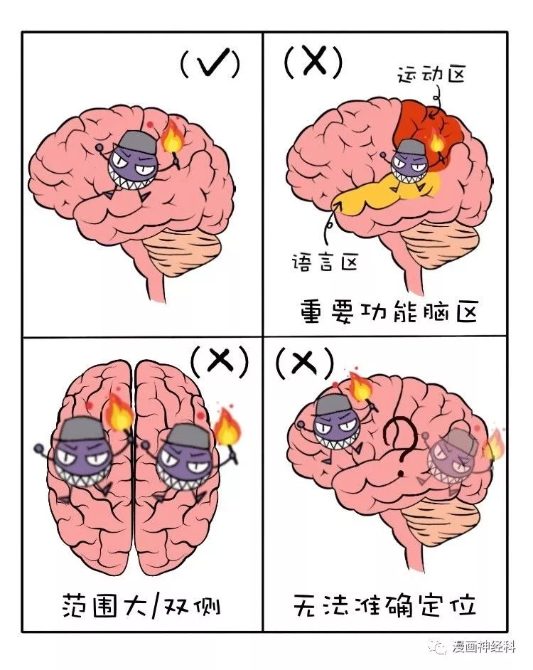 醫學癲癇可以開顱手術治療嗎