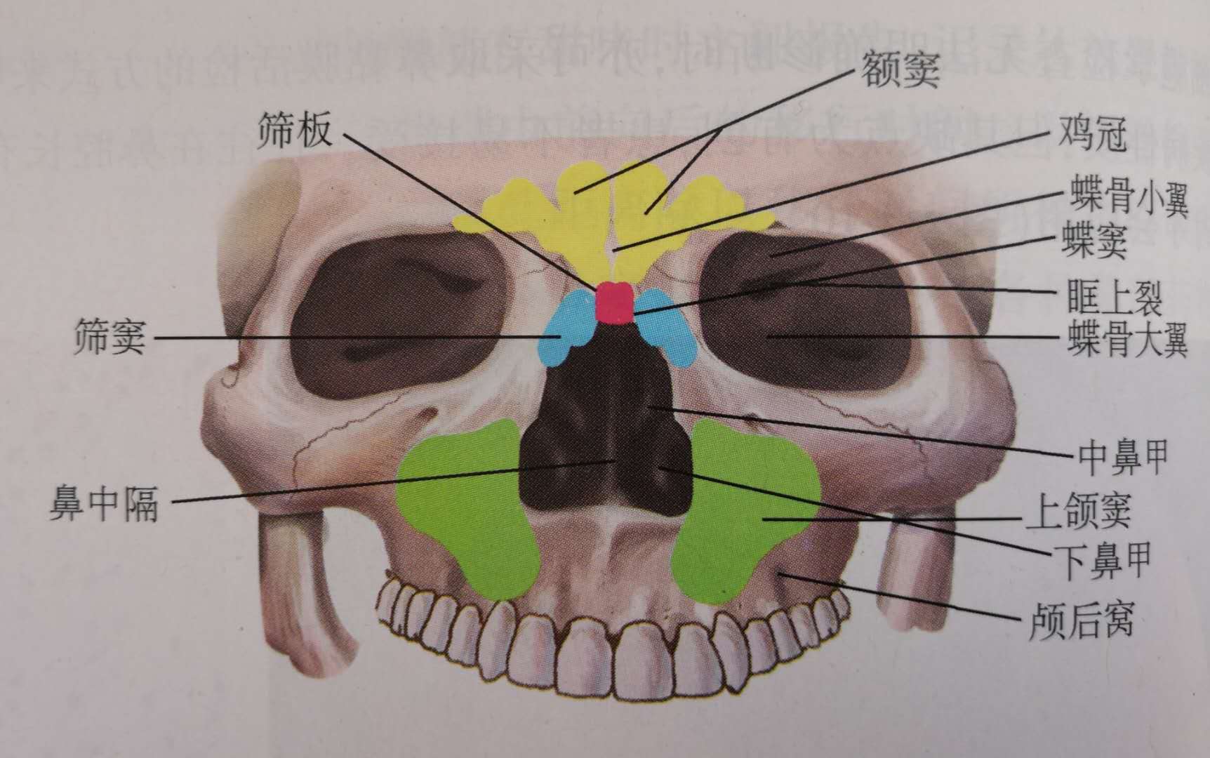 慢性鼻窦炎的诊断和治疗