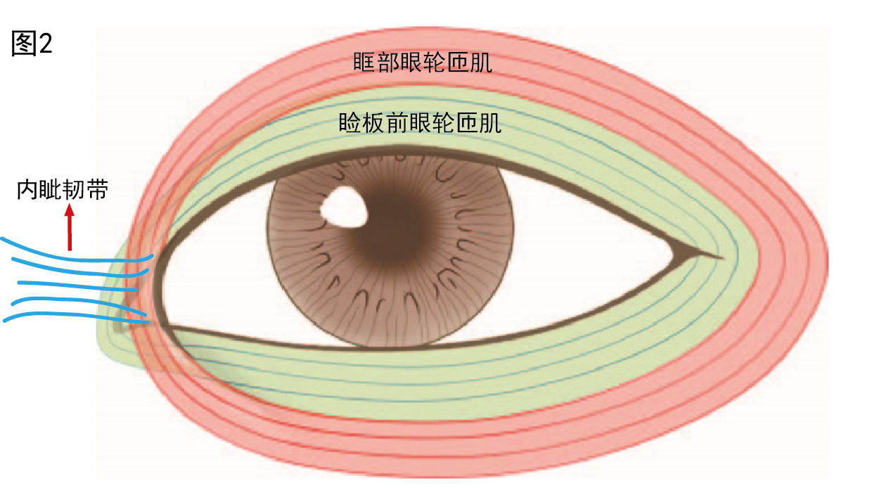 内眦赘皮图片