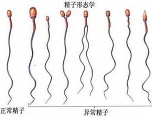 精子正常的检查图图片
