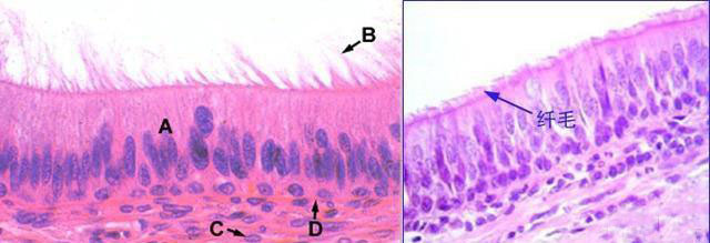 支气管纤毛图片
