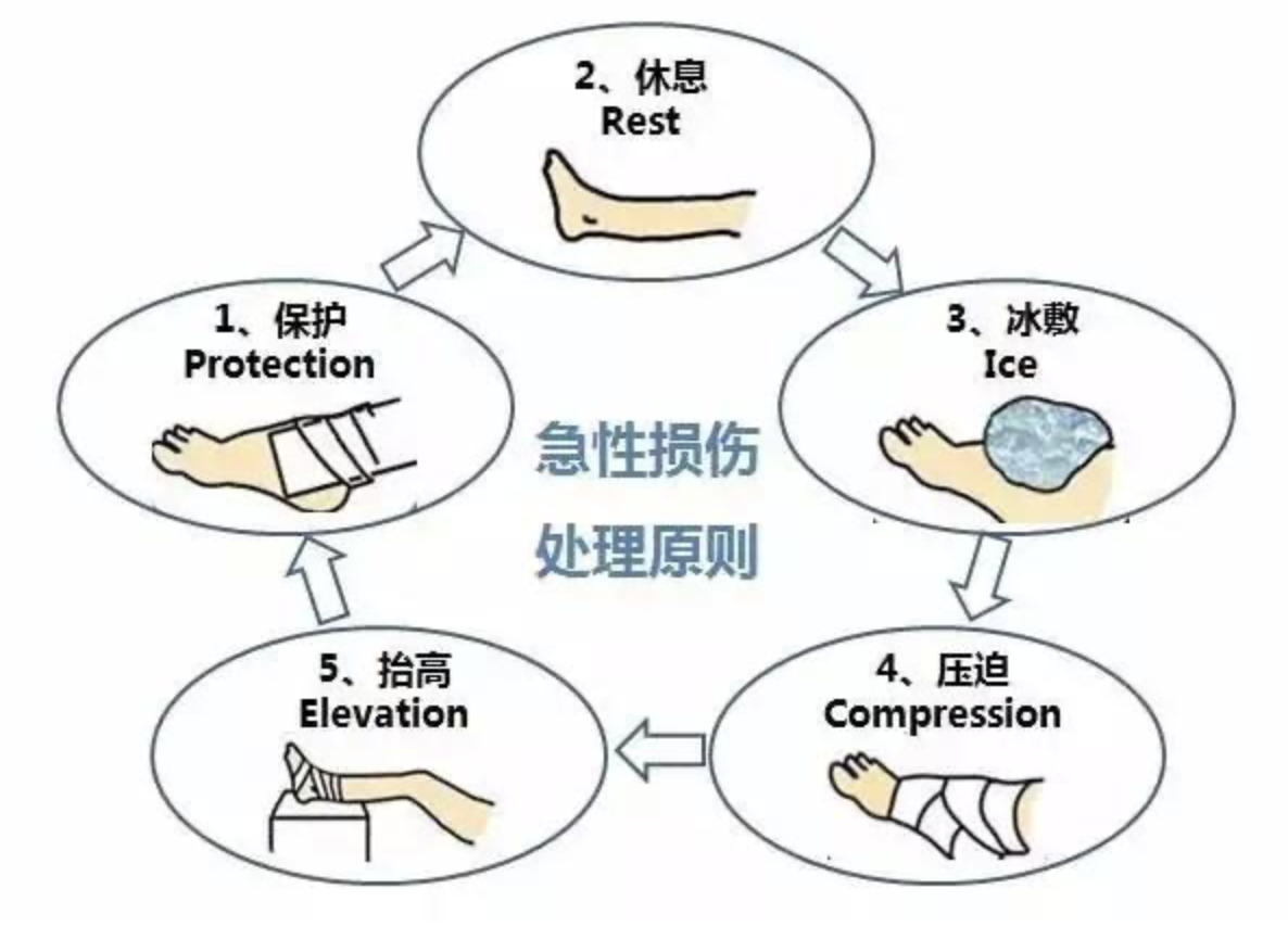 在就诊前如有条件可按rice原则进行处理,踝关节扭伤多因行走不当,外力