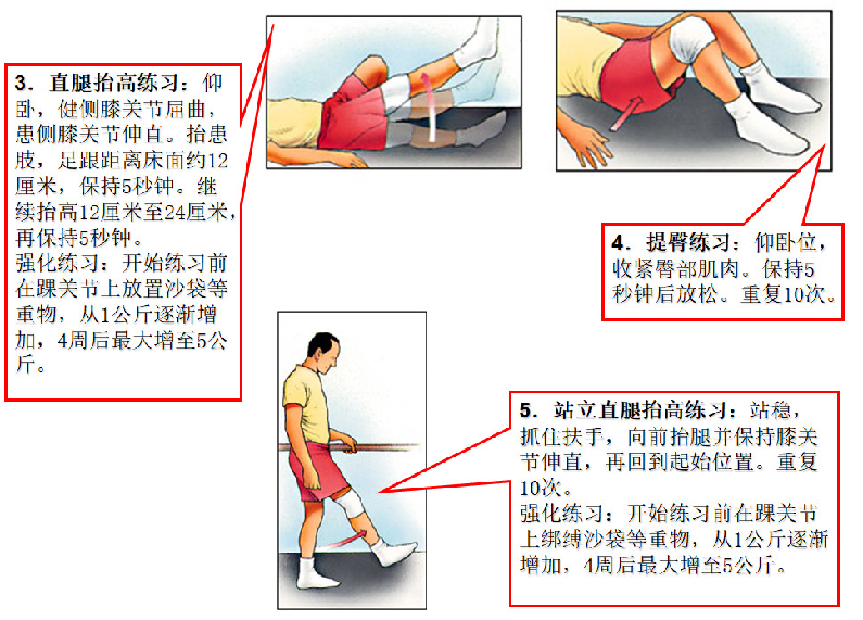 膝关节前交叉韧带损伤术后康复