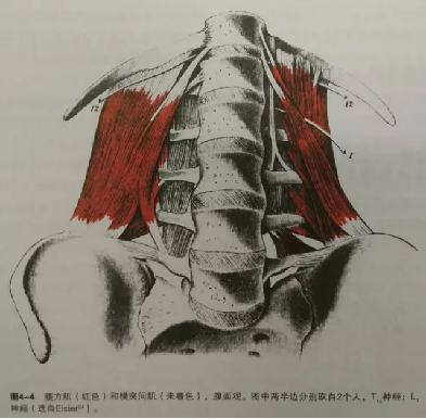 同侧腰方肌阔筋膜张肌产生代偿髋外展肌薄弱(臀中肌,臀小肌),内收肌