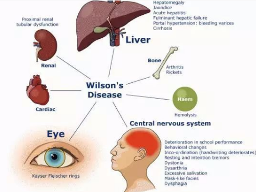 hepatogastric图片