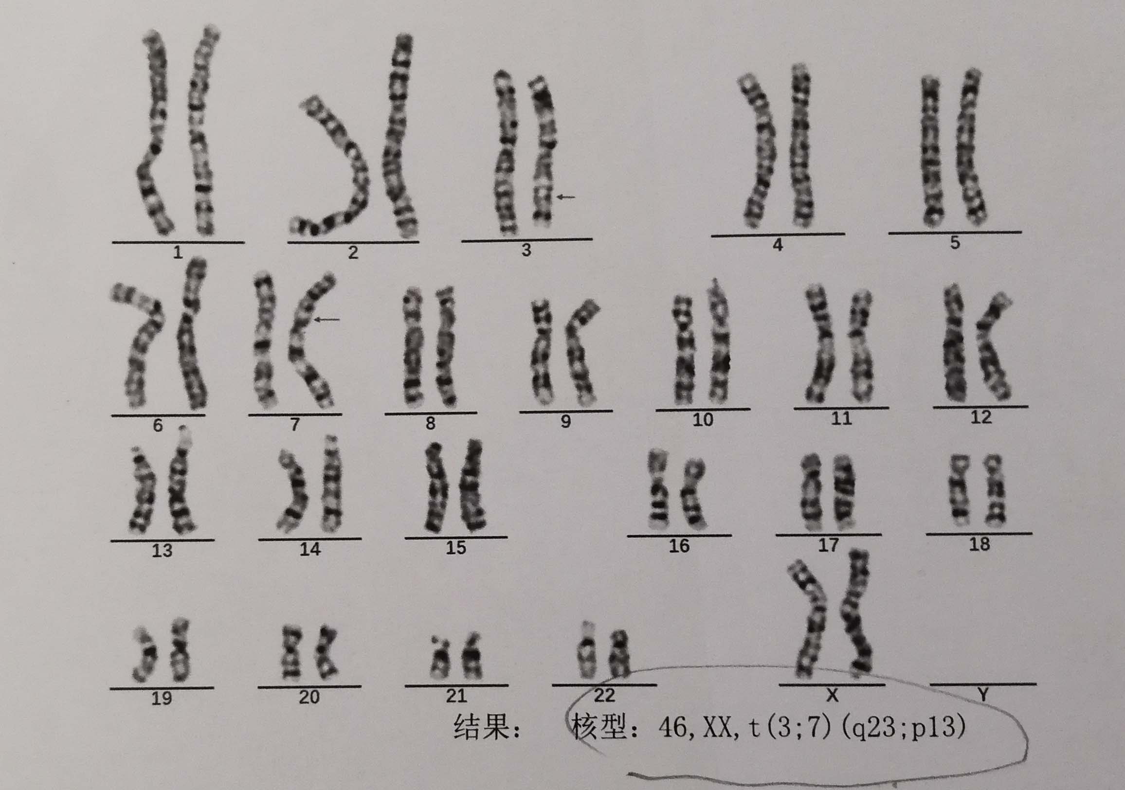 生信软件5 - RIdeogram包绘制染色体密度图_跟着nature genetics学画图:染色体密度图-CSDN博客