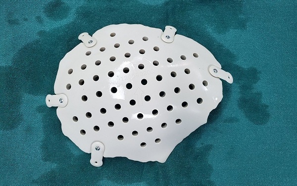 改进后的连接片1,感觉厚一些,强度高一些,但拧螺丝后,peek板的突起更