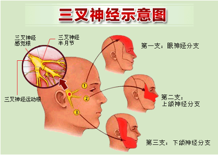 三叉神经解剖图片