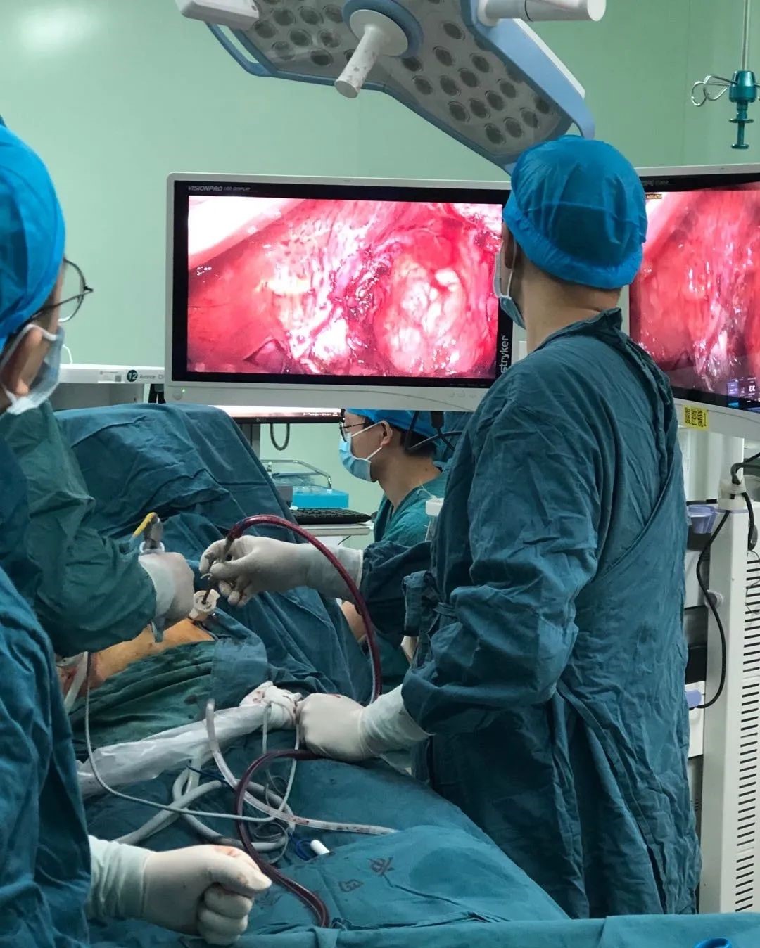 脾气大了可以改脾大了可是要手术