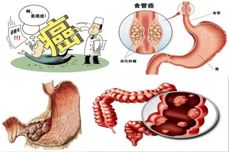 结肠癌卡通图片图片