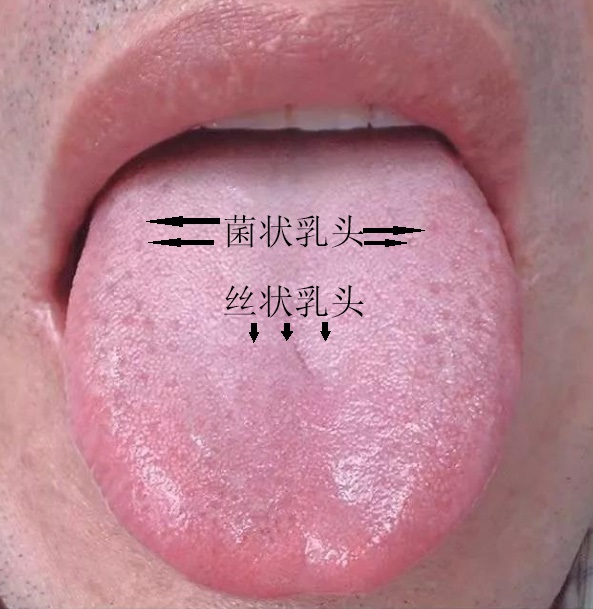 舌下伞襞图片图片