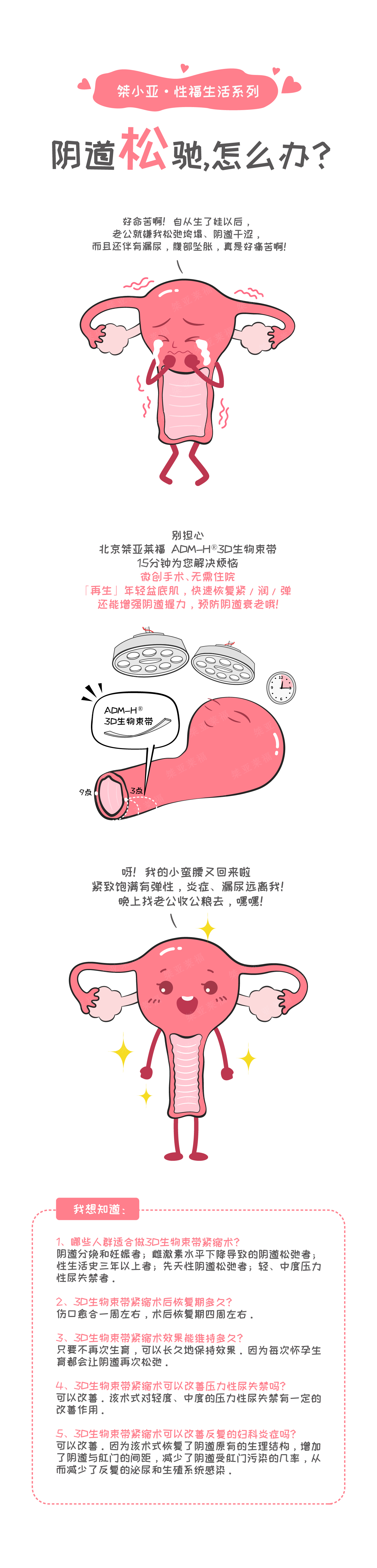 桀小亚*生活-阴道松弛.jpg