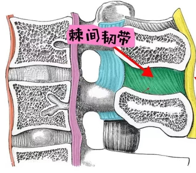 容易被忽视的腰痛原因------棘间韧带炎