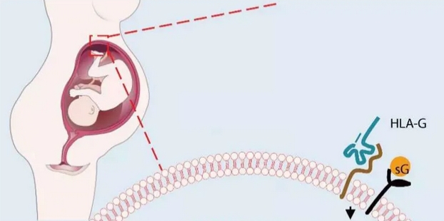 undefined 复发性流产2.png