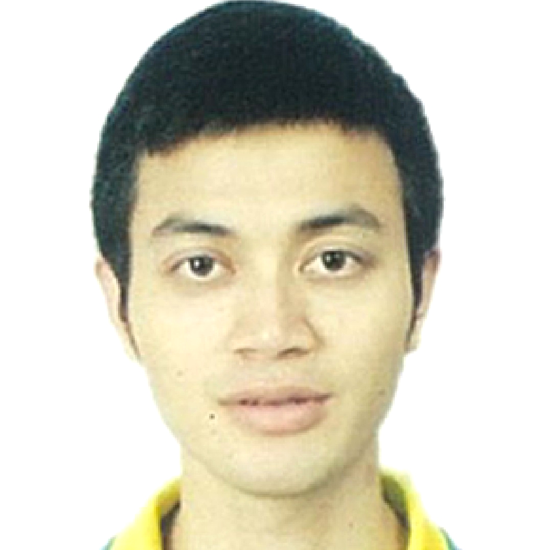 深度龋齿的话,光固树脂补牙能用多久