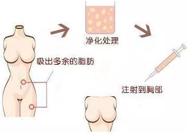春雨医生