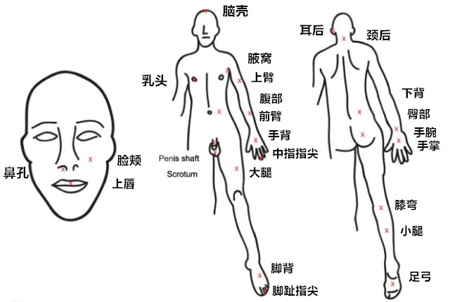 刺痛位置_副本.jpg