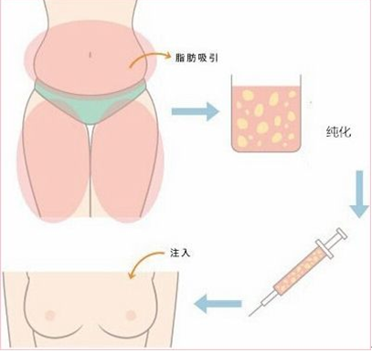 春雨医生
