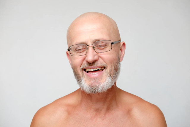 夏天嫌麻烦剃个大光头相信我剃完你会后悔的