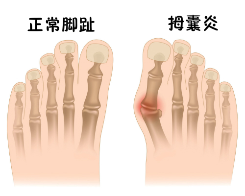 春雨医生