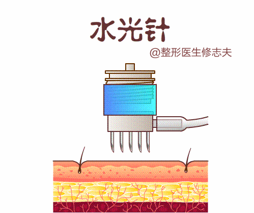 春雨医生