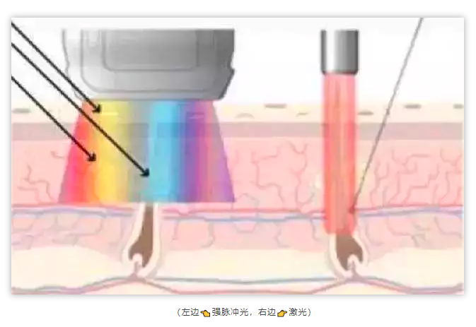 春雨医生