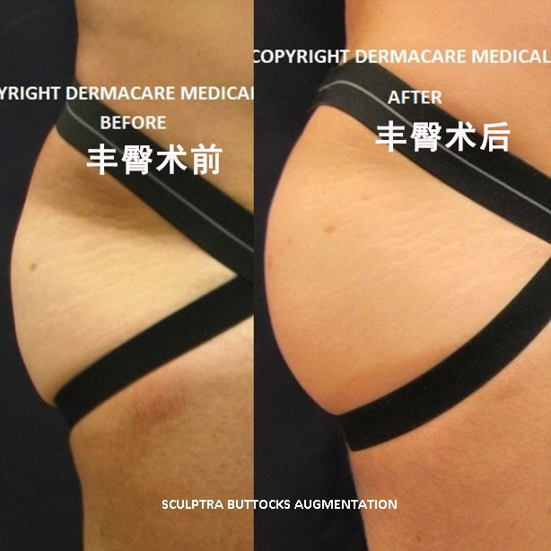 春雨医生 春雨医生