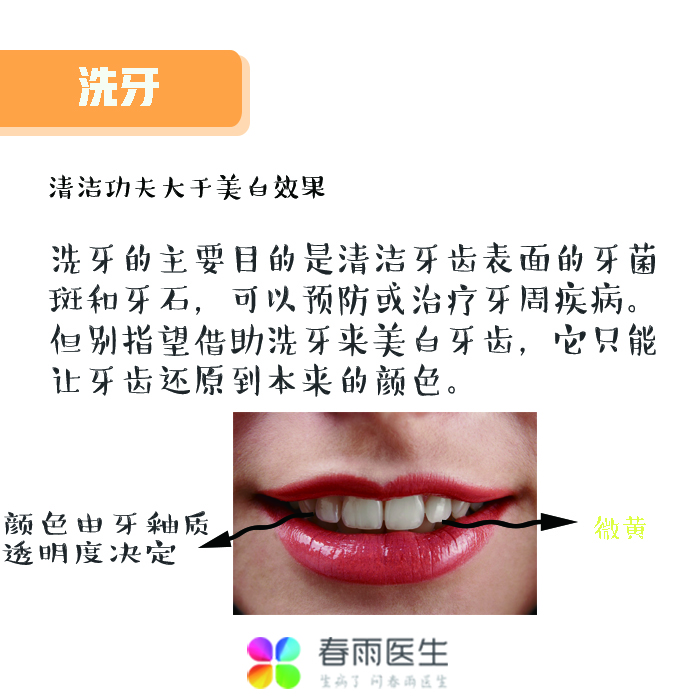 牙齿美白2.jpg