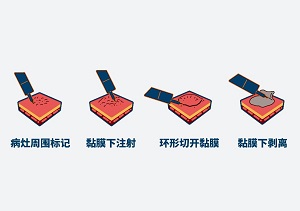 春雨医生