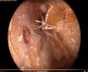 12.gif