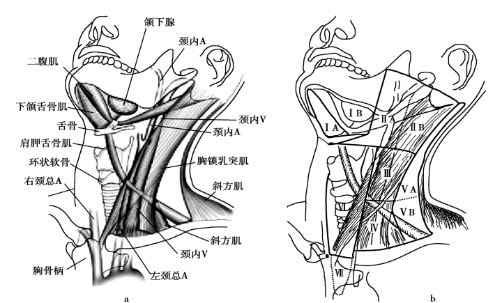 颈动脉鞘淋巴结图片