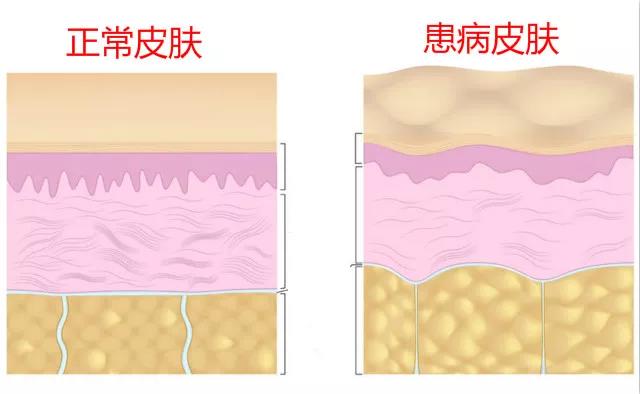 春雨医生