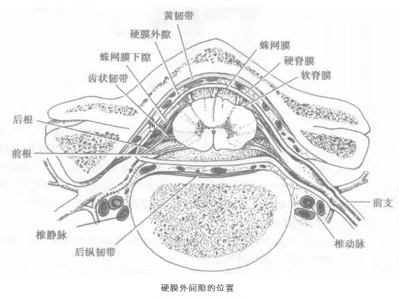 腰椎蛛网膜图片