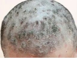 春雨医生 春雨医生